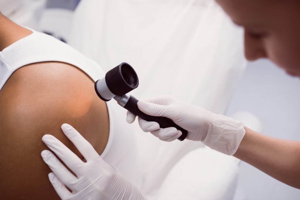 Dermatoscopia